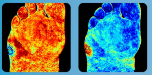 Diabetes-are-Mediial-Devie