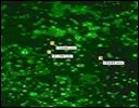 Pharmaceutical-Nanoelastic-Vesicular-Systems